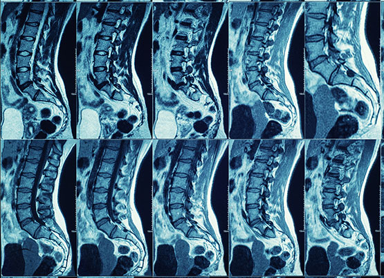 Spinal Imaging is offered by Dr. Katherine Pulse for Patients Who Need It