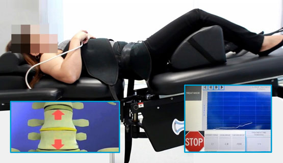 Pulse Chiropractic and Wellness, located in the Memorial Houston area, provides state-of-the-art Spinal Decompression Therapy.