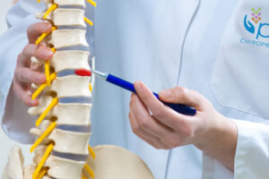 Pulse Chiropractic of Houston, Spinal Disc Herniation