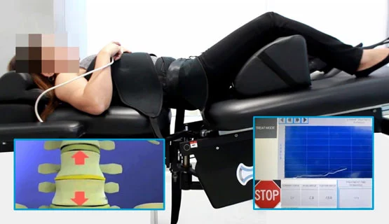 Pulse Chiropractic spinal decompression